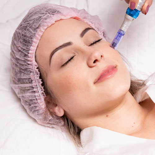 SKIN REJUVENATION in setiba medical spa in westlake village ca