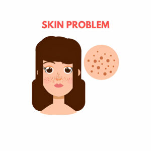 Skin Problem setibamedicalspa
