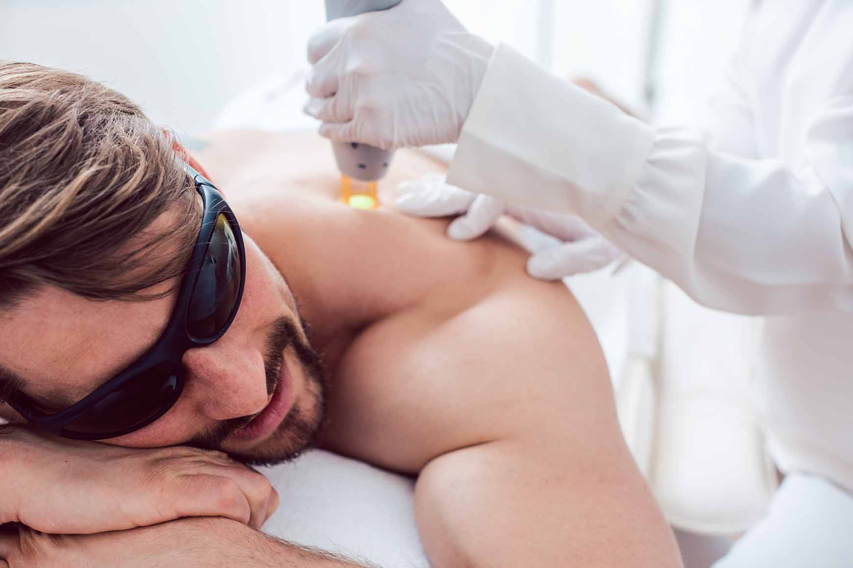 Benefits of Laser Hair Removal