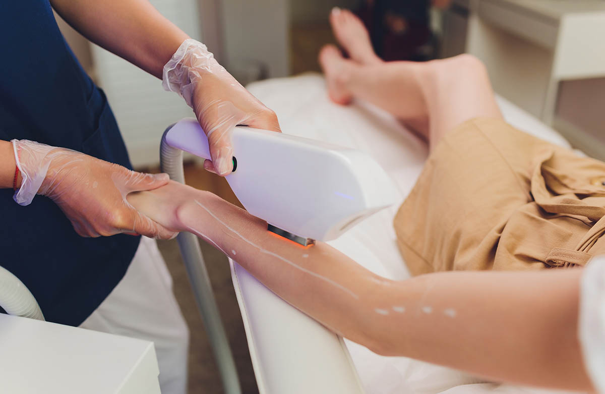 Laser Hair Removal Westlake Village